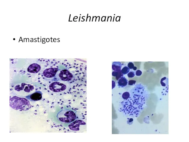 Leishmania Amastigotes