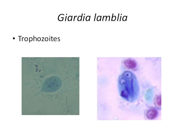 Giardia lamblia Trophozoites