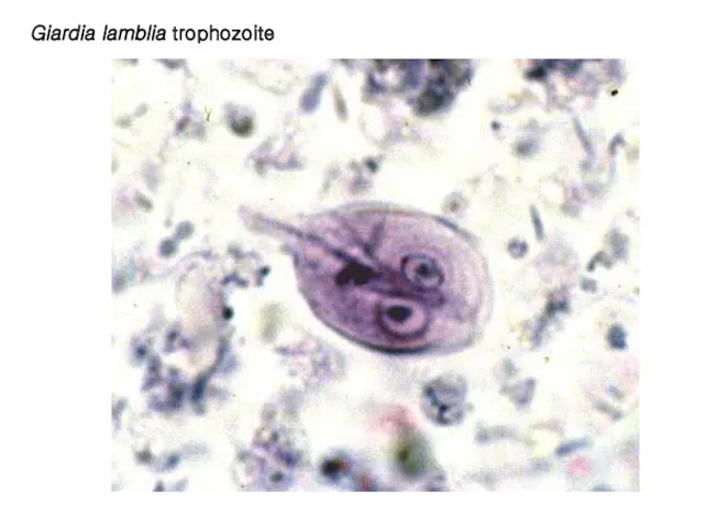 Giardia lamblia trophozoite