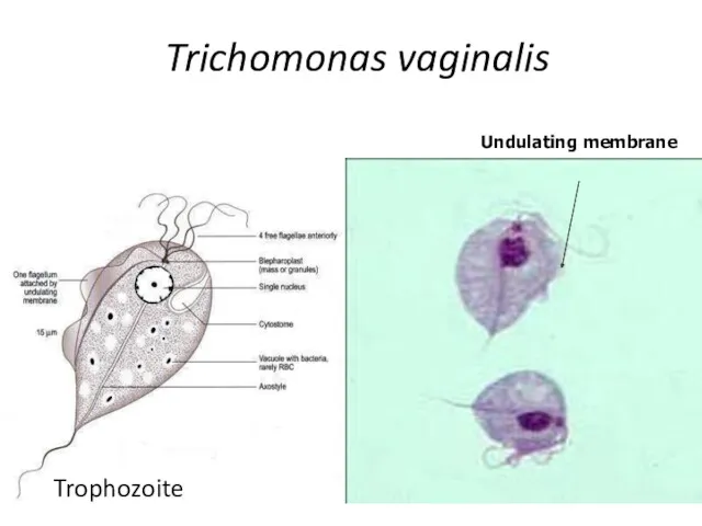 Trichomonas vaginalis Undulating membrane Trophozoite
