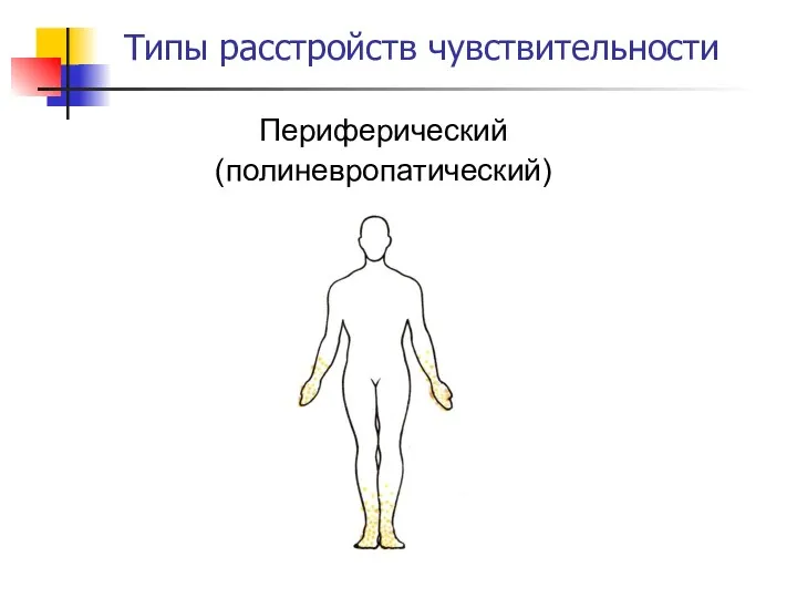 Типы расстройств чувствительности Периферический (полиневропатический)