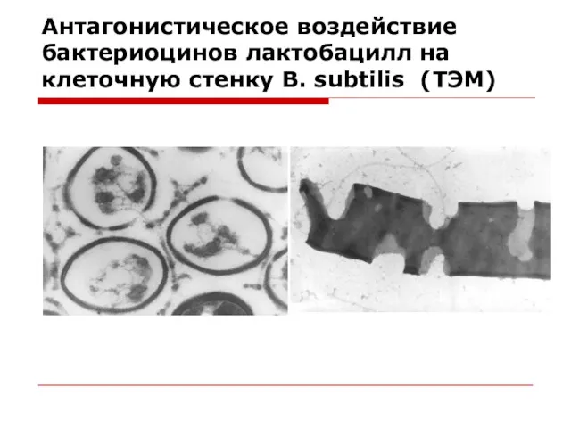 Антагонистическое воздействие бактериоцинов лактобацилл на клеточную стенку B. subtilis (ТЭМ)