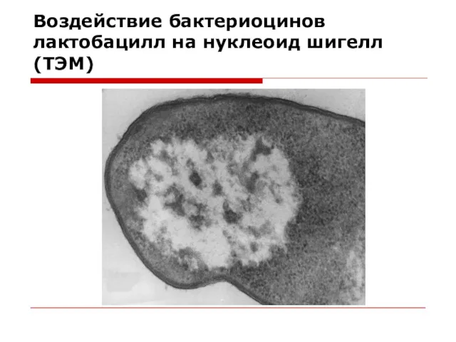 Воздействие бактериоцинов лактобацилл на нуклеоид шигелл (ТЭМ)