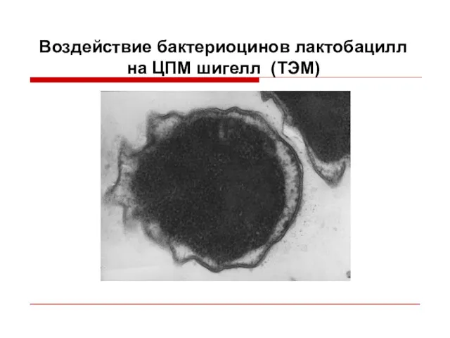 Воздействие бактериоцинов лактобацилл на ЦПМ шигелл (ТЭМ)