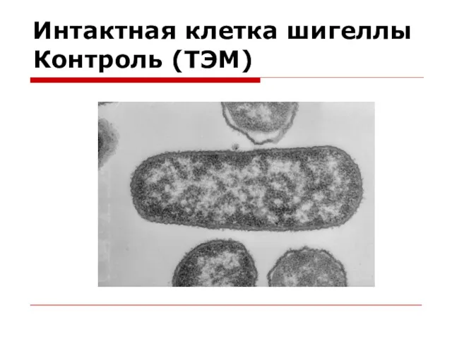 Интактная клетка шигеллы Контроль (ТЭМ)