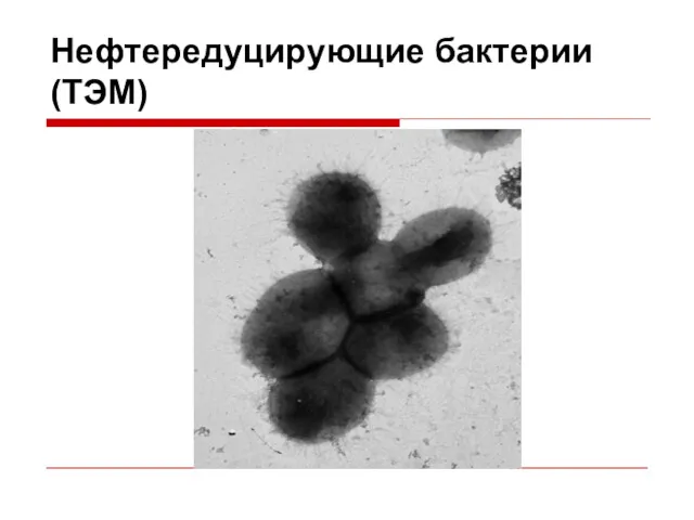 Нефтередуцирующие бактерии (ТЭМ)