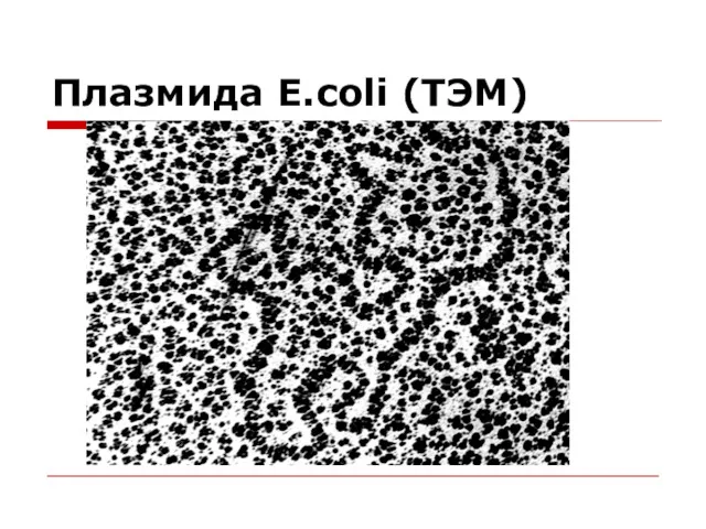 Плазмида E.coli (ТЭМ)