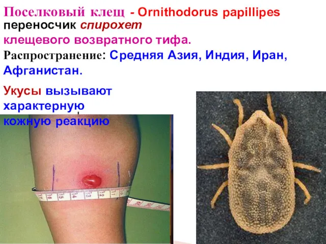 Поселковый клещ - Ornithodorus papillipes переносчик спирохет клещевого возвратного тифа.