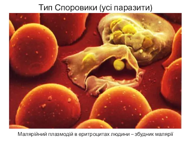 Тип Споровики (усі паразити) Малярійний плазмодій в еритроцитах людини – збудник малярії