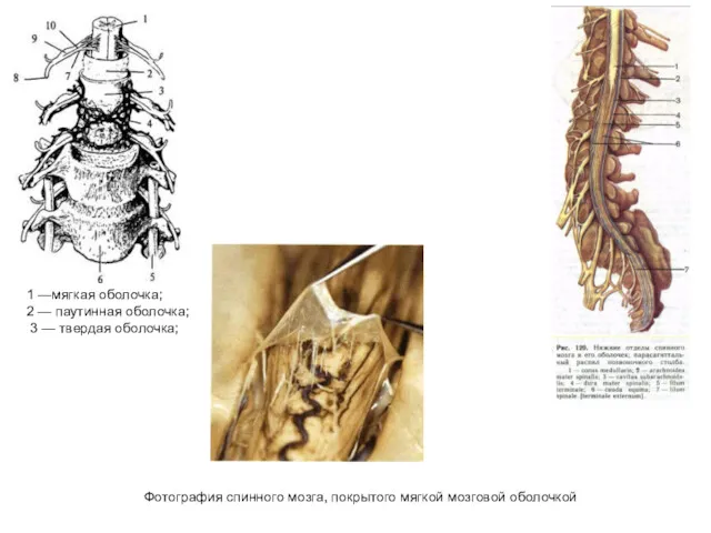 1 —мягкая оболочка; 2 — паутинная оболочка; 3 — твердая