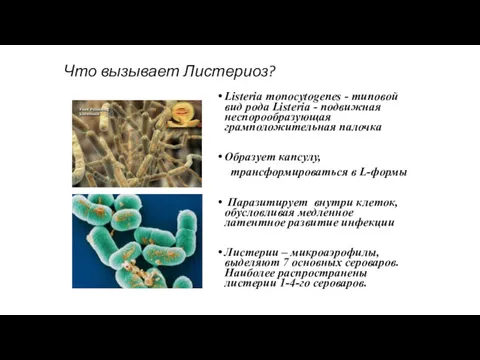 Что вызывает Листериоз? Listeria monocytogenes - типовой вид рода Listeria