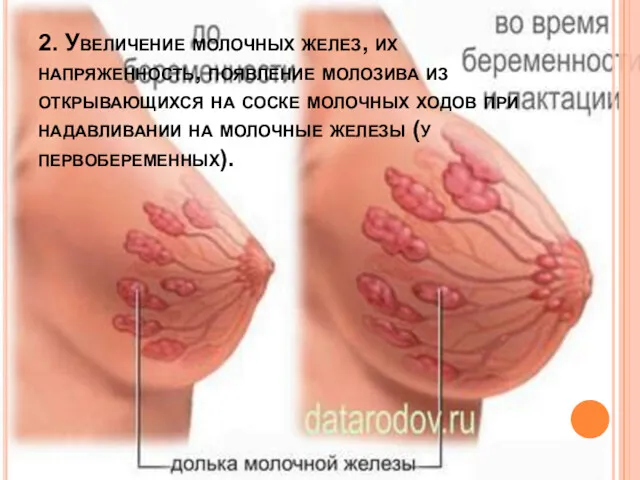 2. Увеличение молочных желез, их напряженность, появление молозива из открывающихся на соске молочных