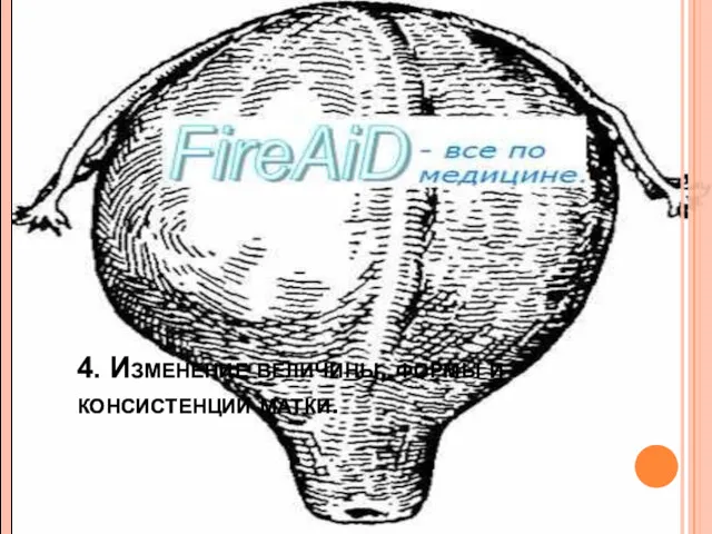 4. Изменение величины, формы и консистенции матки.