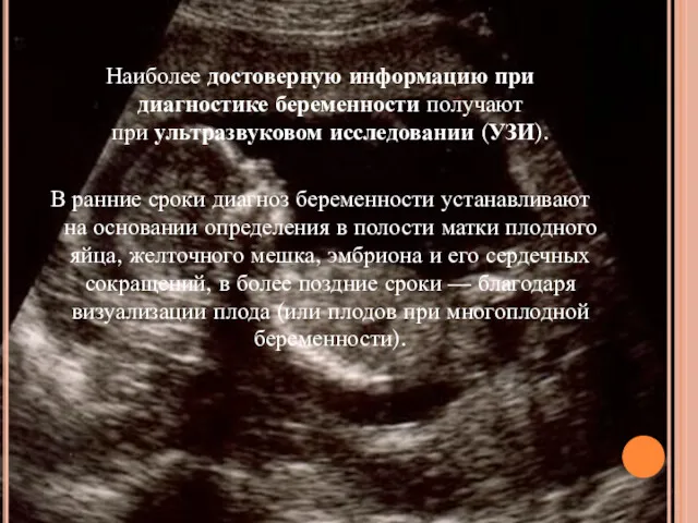 Наиболее достоверную информацию при диагностике беременности получают при ультразвуковом исследовании (УЗИ). В ранние