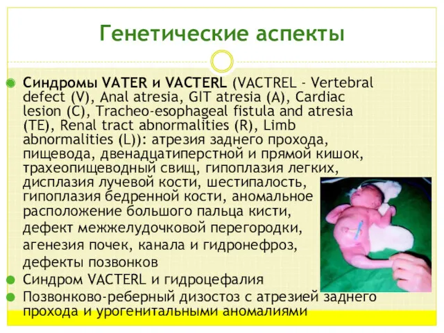 Генетические аспекты Синдромы VATER и VACTERL (VACTREL - Vertebral defect