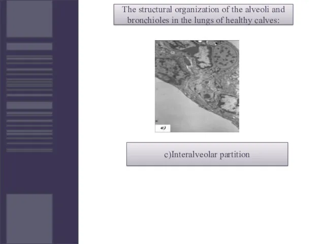 The structural organization of the alveoli and bronchioles in the lungs of healthy calves: c)Interalveolar partition