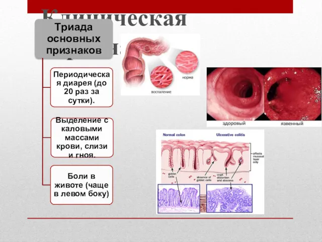 Клиническая картина