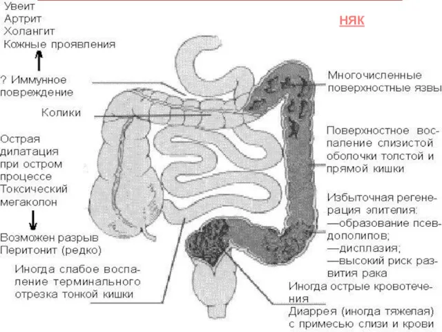 НЯК