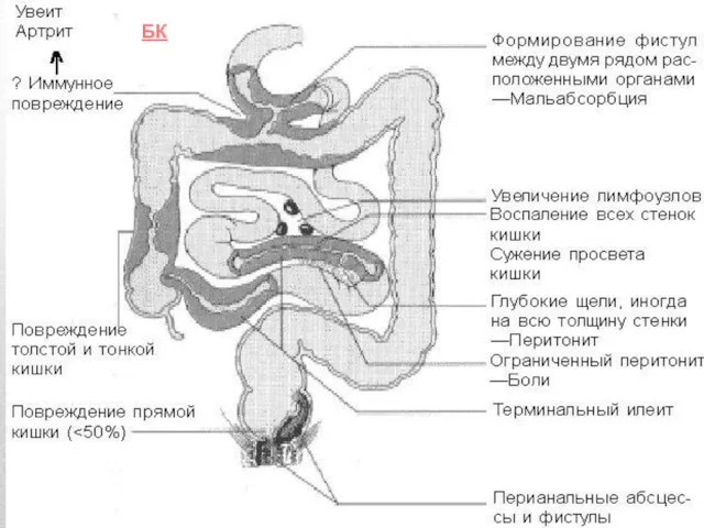 БК