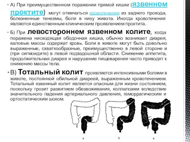 А) При преимущественном поражении прямой кишки (язвенном проктите) могут отмечаться