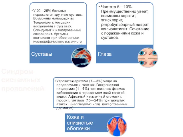 Синдром системных проявлений