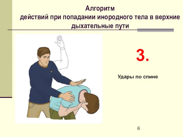 Алгоритм действий при попадании инородного тела в верхние дыхательные пути 3. Удары по спине