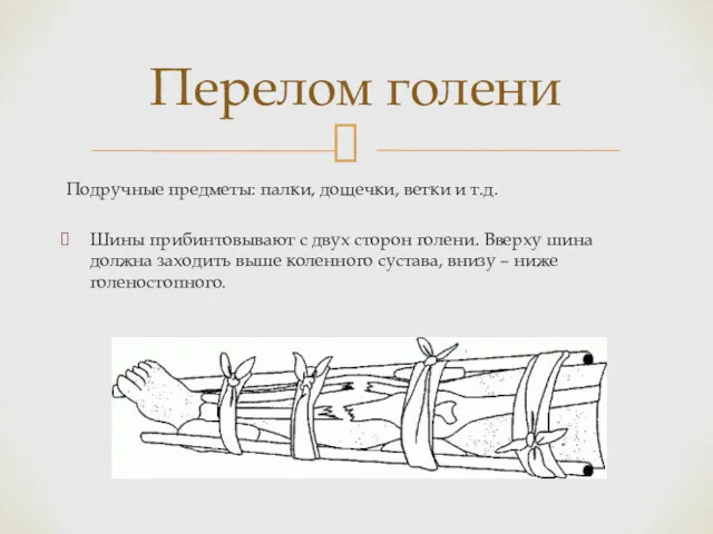 Перелом голени Подручные предметы: палки, дощечки, ветки и т.д. Шины