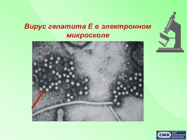 Вирус гепатита Е в электронном микроскопе