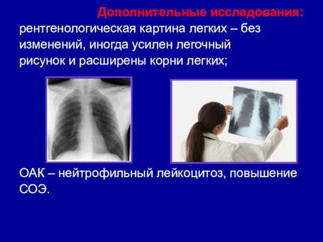 Дополнительные исследования: рентгенологическая картина легких – без изменений, иногда усилен