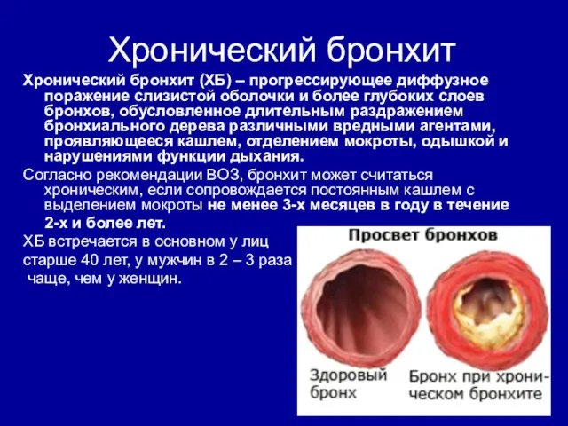 Хронический бронхит Хронический бронхит (ХБ) – прогрессирующее диффузное поражение слизистой