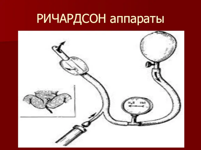 РИЧАРДСОН аппараты