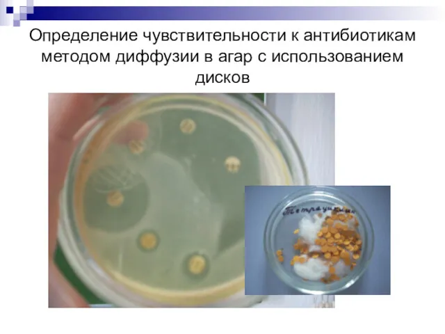 Определение чувствительности к антибиотикам методом диффузии в агар с использованием дисков