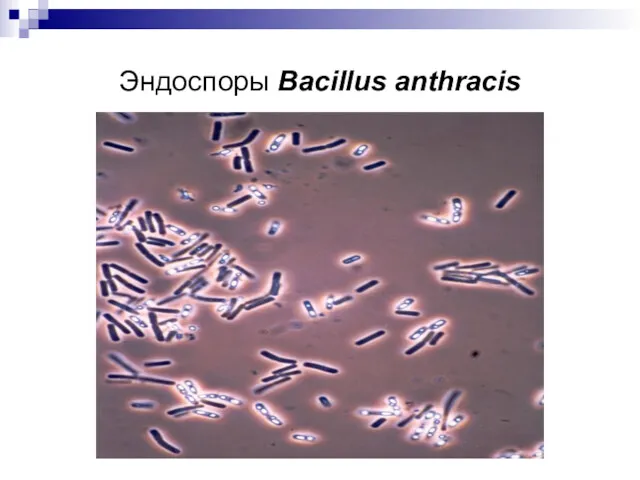 Эндоспоры Bacillus anthracis