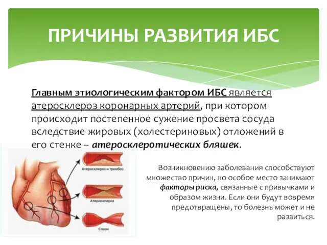 ПРИЧИНЫ РАЗВИТИЯ ИБС Главным этиологическим фактором ИБС является атеросклероз коро­нарных артерий, при котором