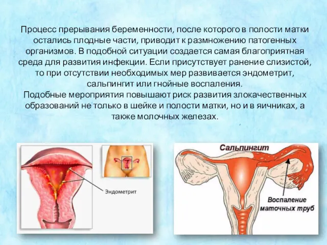 Процесс прерывания беременности, после которого в полости матки остались плодные части, приводит к