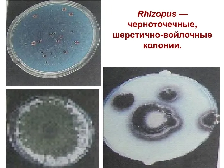 Rhizopus — черноточечные, шерстично-войлочные колонии.