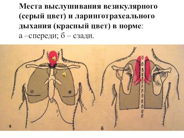 Места выслушивания везикулярного (серый цвет) и ларинготрахеального дыхания (красный цвет)