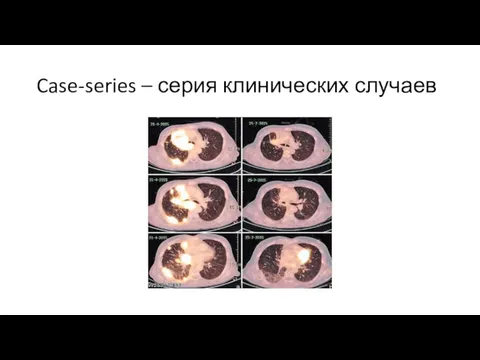 Case-series – серия клинических случаев