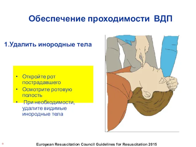 © European Resuscitation Council Guidelines for Resuscitation 2015 Обеспечение проходимости