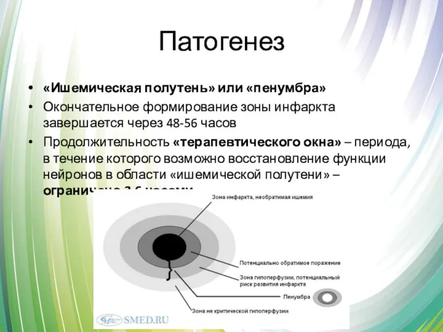 Патогенез «Ишемическая полутень» или «пенумбра» Окончательное формирование зоны инфаркта завершается