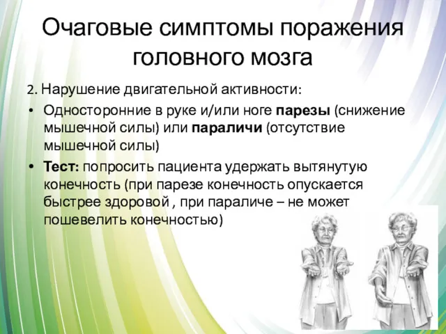 Очаговые симптомы поражения головного мозга 2. Нарушение двигательной активности: Односторонние