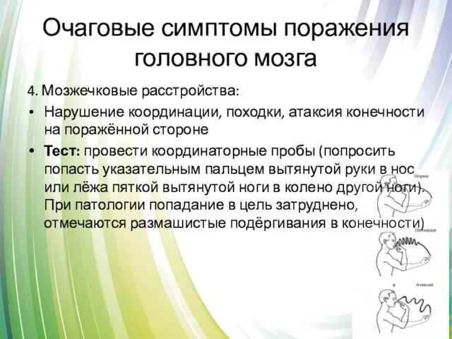 Очаговые симптомы поражения головного мозга 4. Мозжечковые расстройства: Нарушение координации,