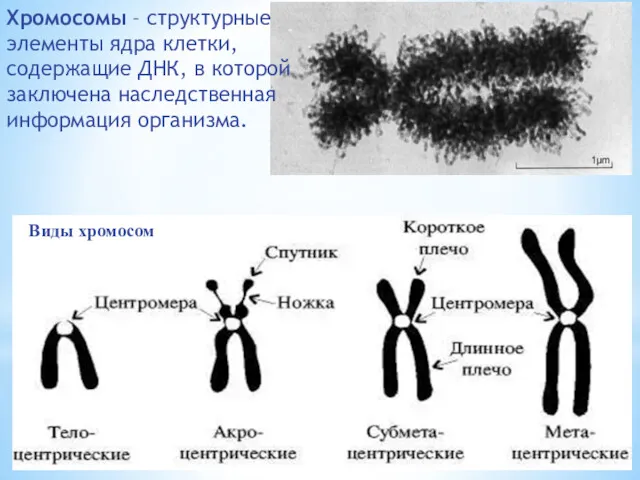 Виды хромосом Хромосомы – структурные элементы ядра клетки, содержащие ДНК, в которой заключена наследственная информация организма.