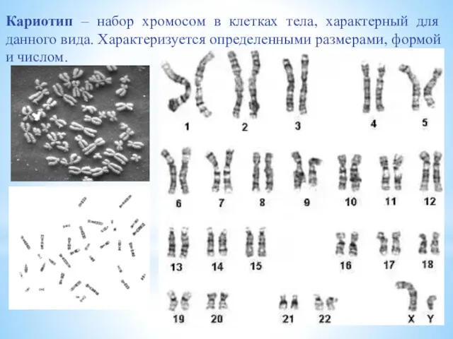 Кариотип – набор хромосом в клетках тела, характерный для данного