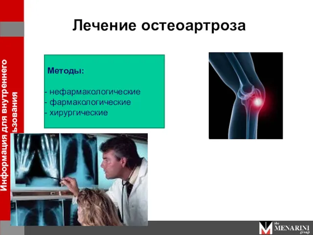 Лечение остеоартроза Методы: нефармакологические фармакологические хирургические