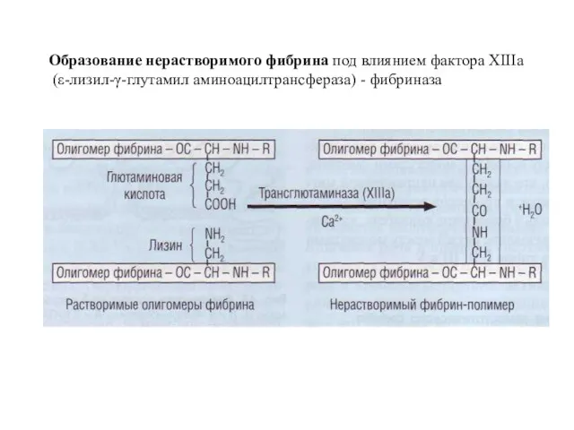 Образование нерастворимого фибрина под влиянием фактора ХIIIа (ε-лизил-γ-глутамил аминоацилтрансфераза) - фибриназа