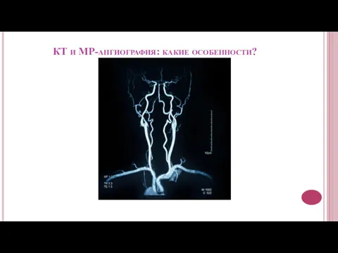 КТ и МР-ангиография: какие особенности?