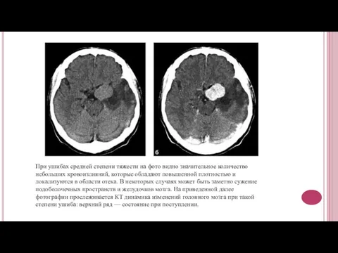 При ушибах средней степени тяжести на фото видно значительное количество