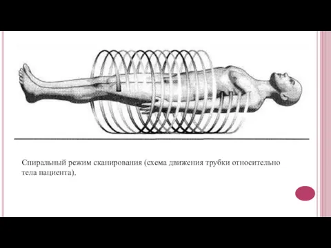 Спиральный режим сканирования (схема движения трубки относительно тела пациента).