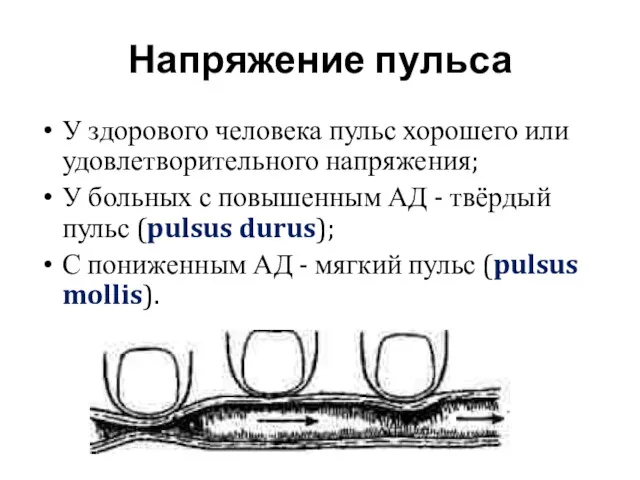 Напряжение пульса У здорового человека пульс хорошего или удовлетворительного напряжения;